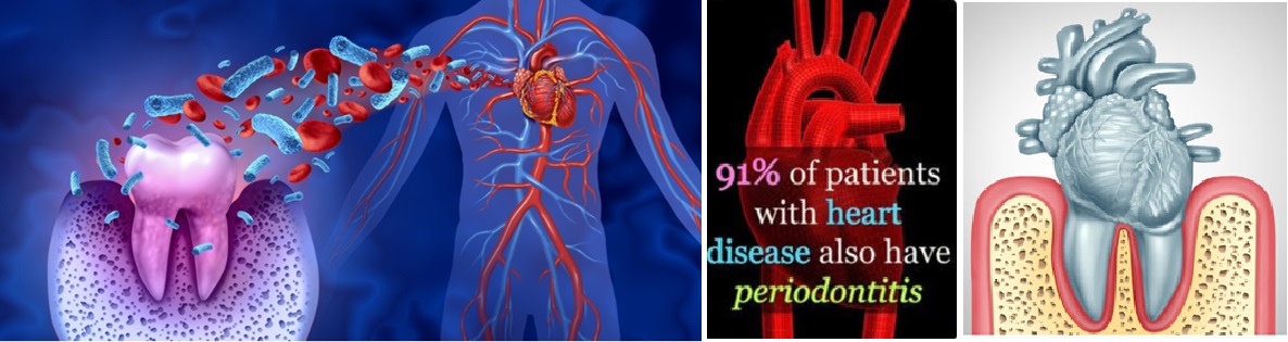 Exploring The Surprising Link Between Cardiovascular Disease And Dental Issues