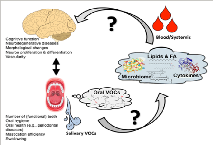 Exploring The Link Between Alzheimer's Disease And Oral Health